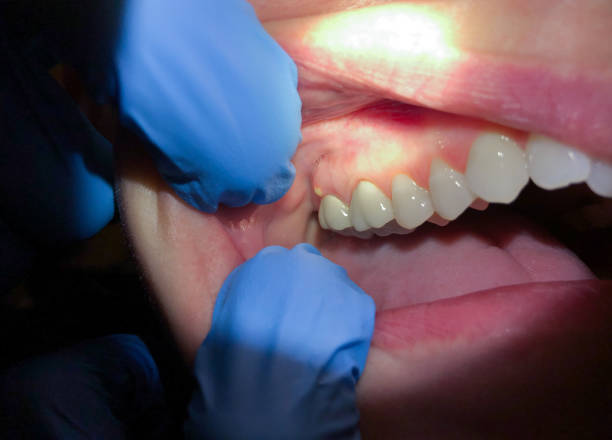 Best Weekend Emergency Dentist in Waynesburg, OH