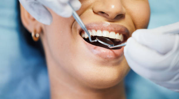 Best Broken or Cracked Tooth Emergency Dentist in Waynesburg, OH